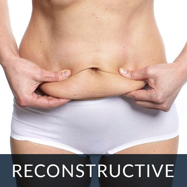 flip-reconstructive cosmetic surgery reconstruction
