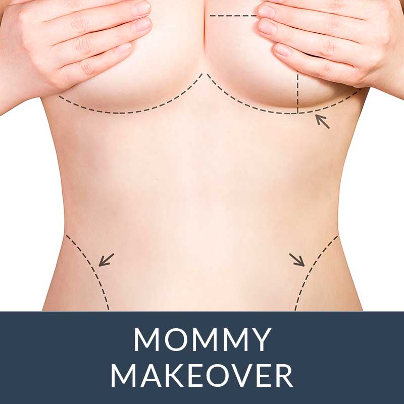 mommy makeover atlanta
